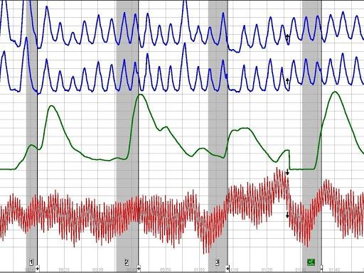 Polygraph and Investigations